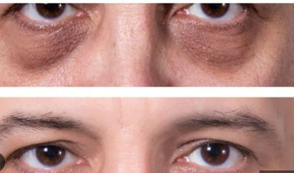 MEN EXPERT - ROLLER ANTI OJERAS