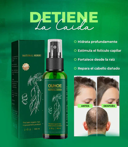 OUHOE™ - ELIXIR CAPILAR 100% EFECTIVO