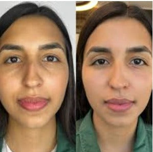 MEN EXPERT - ROLLER ANTI OJERAS