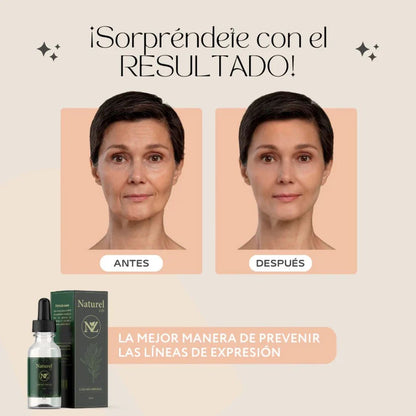 SERUM ANTI ARRUGAS