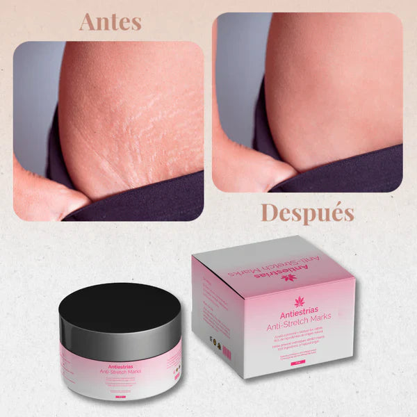 CREMA ANTI ESTRÍAS