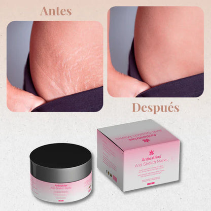 CREMA ANTI ESTRÍAS