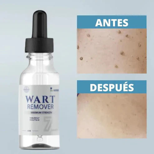 WART REMOVEDOR DE VERRUGAS Y LUNARES